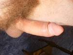 btomp